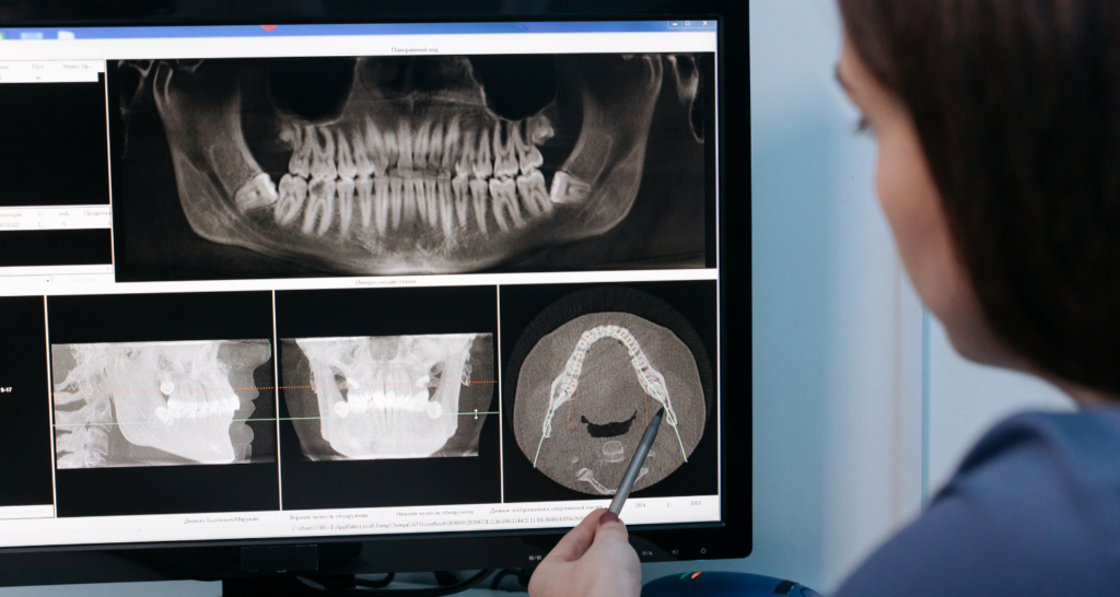 Dentista che guarda lastra denti sul PC