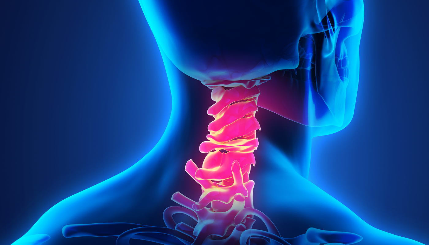 Cervicalgia: le 10 principali cause del dolore al collo