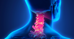 Cervicalgia: le 10 principali cause del dolore al collo