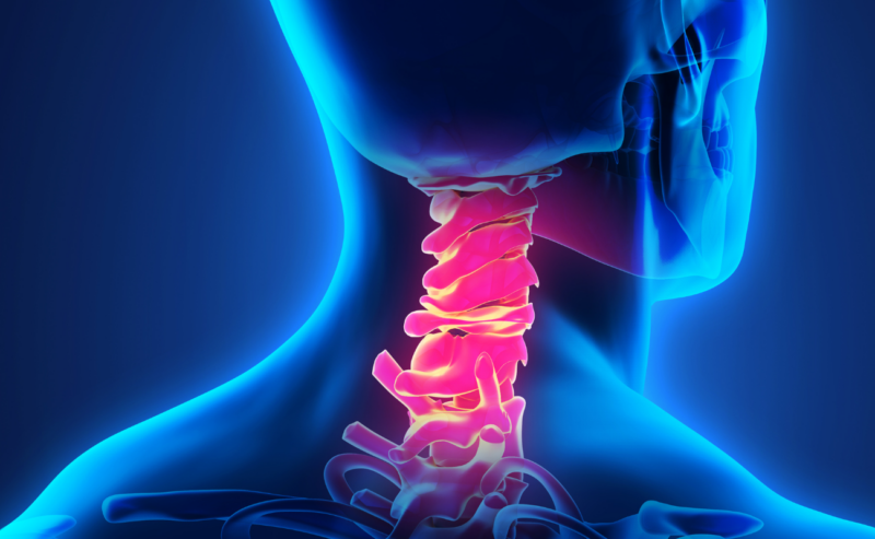 Cervicalgia: le 10 principali cause del dolore al collo