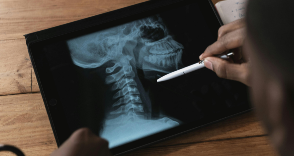 Medico che guarda una risonanza per vedere la presenza di ernie o protusioni